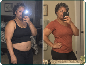 Illustrative example 5: before and after comparison